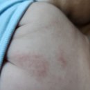 본소아청소년과의원 이미지