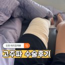 인천고주파 | 인천 하지정맥류 고주파 수술 후기