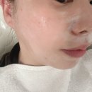 매안초등학교 | 순천 피부샵 피부관리 리브스킨 더마트라이 솔직후기