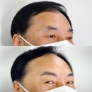 미채움떡 | 동대문 눈썹 당일부터 자연스러운 남자 눈썹 후기 ( 미채움 페더링 눈썹 )