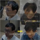 이진헤어(당진점) | 머리숱 없는 남자 머리 머리빨 프로젝트