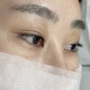 하이.롬블리 이미지