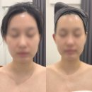 성남대로331번길 | 분당윤곽관리 에스테틱다리아 분당정자점 작은 얼굴 만들기 후기