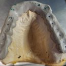 엘리트치과기공소 이미지