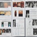 척추측만증 교정-독일식 슈로스 운동(Schroth Method) 전문가 과정＜PDF 파일제공＞ 2025년 11월 23일(일) 이미지