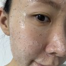 (주)델리코 | 인스타 화장품 델리케어 델리살구팩 여드름성 피부가 사용한 솔직후기
