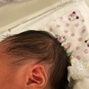 진아이텍 | 일산동국대병원 아기 스킨텍 상담 후기(시술 미결정)