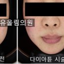 유올림의원 네이버블로그