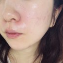 선약국 | 시술후 선크림 추천 | 파마유브이 PDRN 선세럼 약국선세럼 사용 후기