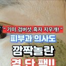 기미 검버섯 흑자 지우개. 이미지