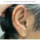 독일보청기 부천원미구청센터 | 독일보청기 부천원미구청센터에서 부천보청기 착용해보고 든 생각