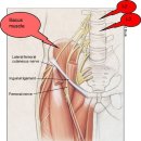 Femoral nerve Entrapment Case report 이미지