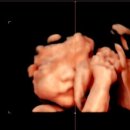 도곡함춘산부인과의원 이미지