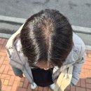 라인2차 | 용인 DOT FOR YOU SMP | 정수리 3차 헤어라인2차 후기