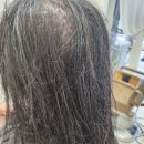 예예 미장원 | BTX 비건클리닉 후기입니댜
