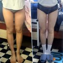 재성한의원 | 성수동다이어트 당독소 다이어트 한약 내돈내산 리얼후기(비대면 처방)