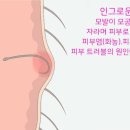 헤어후 - 양구군 | 헤어후