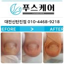 푸스케어대전신탄진점 네이버블로그