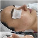 비비피부관리 네이버블로그