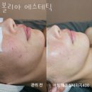 경찰병원.KT가락지사 | 가락동피부관리 볼리아 에스테틱 위치.가격.시간.후기