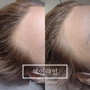 체인지헤어라인 이미지