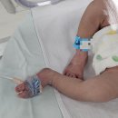 신생아 중환자실 집중치료실 NICU 니큐 입원 치료 기간 비용