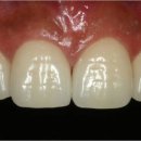 비타민치과기공소 이미지