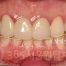 원탑 치과기공소 이미지