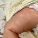 4개월 아기 건조한 피부 습진 대전 “토리 소아과” 예약 진료 후기