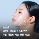수원 리프팅 시술 총정리 비교해보기 (수원메디큐브)