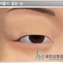 세민성형외과의원 네이버블로그