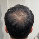 가까운평화약국 | 탈모약 가격 비교부터 온누리상품권까지 써본 후기