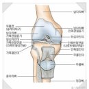 무릎인공관절수술, 인공관절치환술 후 관리 및 재활치료 이미지