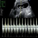 내포우리약국 | [임신일기] 다사다난한 둘째 만나기😮