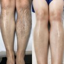 이바뷰티1 | 올여름 민소매/반바지 자신있게! 부산연산동 팔/종아리왁싱 후기