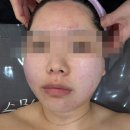 동부공원로 | [평택] 피부관리 / 에르벨에스테틱에서 여드름 관리 받고 온 후기 (솔직 리뷰)