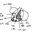 복강경하 자궁근종 절제술 - 다발성 ( 6.2 Cm, 4 Cm, 2.6 Cm, 1.9 Cm,1 Cm, 1.3 Cm, 1.6 Cm, 0.8 Cm ) 이미지