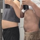 분당-93 | 위례마운자로 효과 고민되시나요? 고도비만 15kg 감량 리얼 후기 쥬비스분당