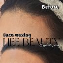 희헤어라인 이미지