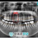 서원동-18 네이버블로그
