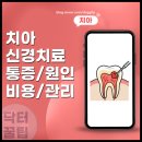 와동킴스치과의원 | 용인 마북동 치과 치아 신경치료 후 통증 비용 치료 과정 후 기간