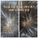 1회 사진기록전 | 탈모 예방 두피 엑소좀 내돈내산 1회차 일주일 후 2회차 기록