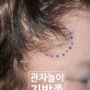 강남피부성형외과 네이버블로그