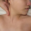 하수구 닥터(Dr) | 구리피부관리샵 닥터제이에스테틱에서 신부관리 모공스케일링 받은 후기