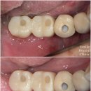 스마일부부치과의원 이미지