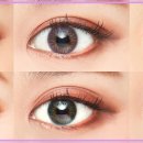 명일콘택트렌즈 이미지