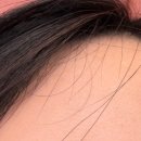 쁨글로벌의원 이미지