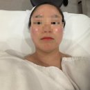 머드퍼밍 | 선릉 피부관리 하이필스킨 강남선릉점 여드름 흉터 후기