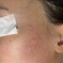 광진산소 | 군자 피부관리 우아에스테틱 산소 버블 테라피 후기