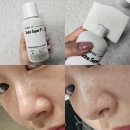 블랙헤드추천템 메디필 엑스트라 슈퍼9플러스 코팩대신 녹여서 관리해요